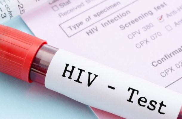 Namibia making strides in fight against HIV – Minister