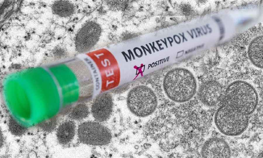 Third possible case of monkeypox found in the US