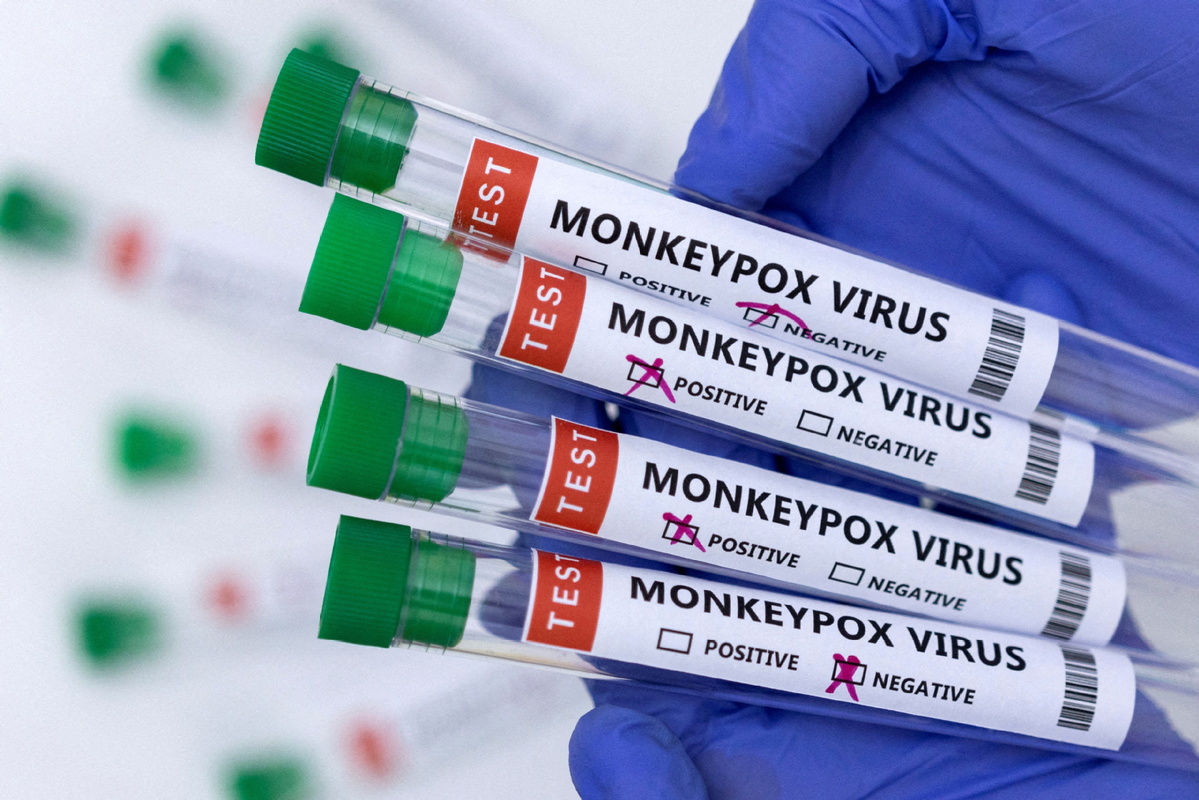 Monkeypox declared notifiable disease in Britain