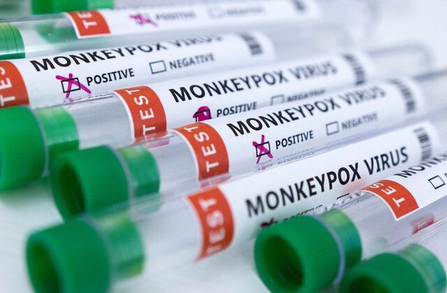 Britain records 104 more monkeypox cases