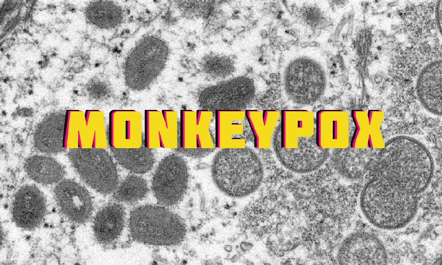 Greece confirms first case of monkeypox