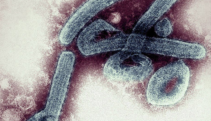 Ghana confirms first cases of deadly Marburg virus