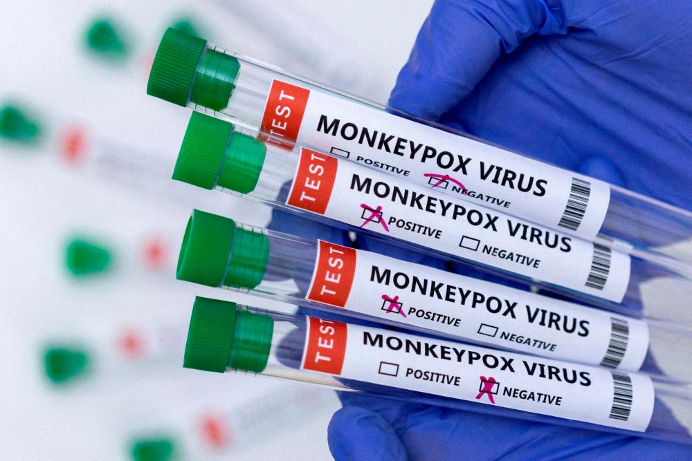 US expects monkeypox cases to continue climbing through August