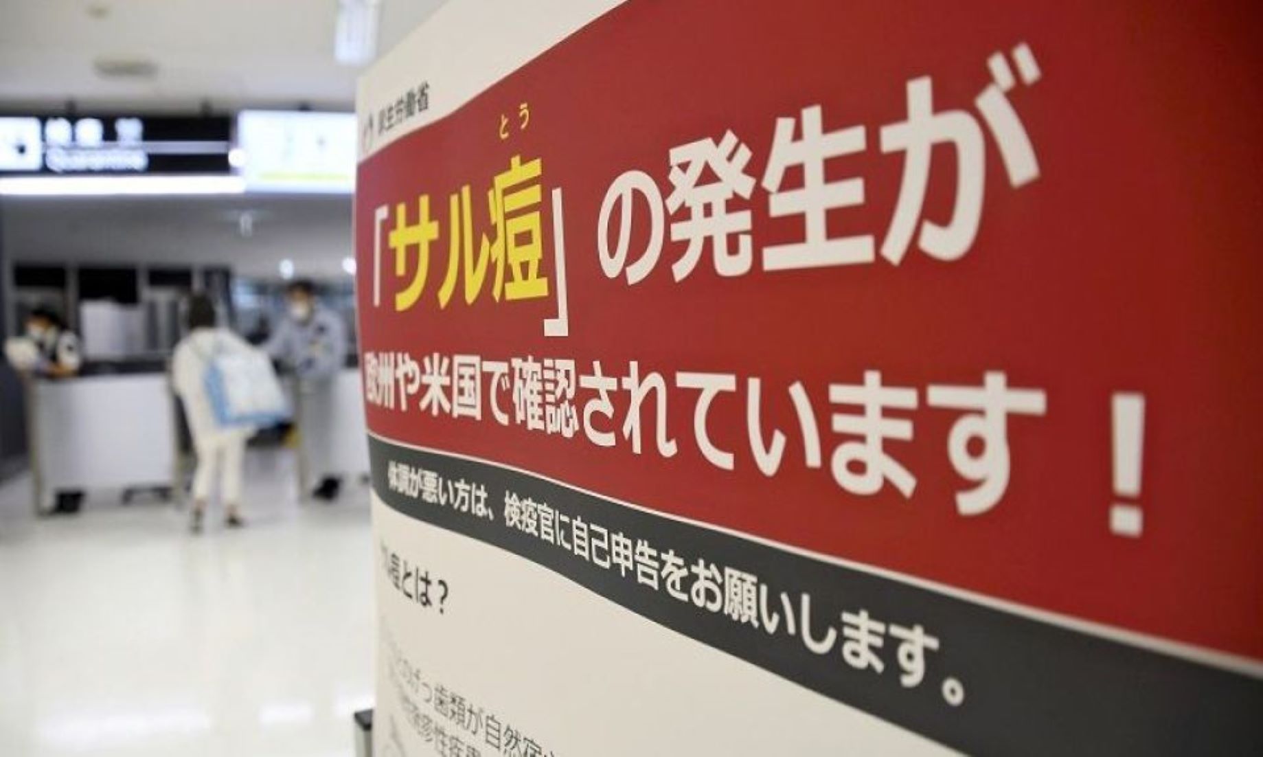 Japan Reported Second Case Of Monkeypox In Tokyo