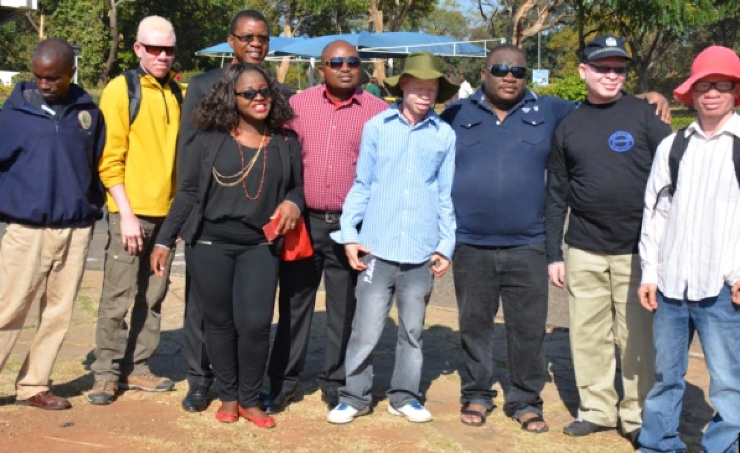 Malawi Police welcomes country’s first Albino officers