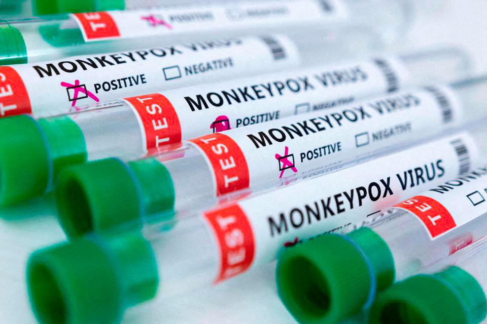 Cuba’s first monkeypox case recorded in Italian tourist