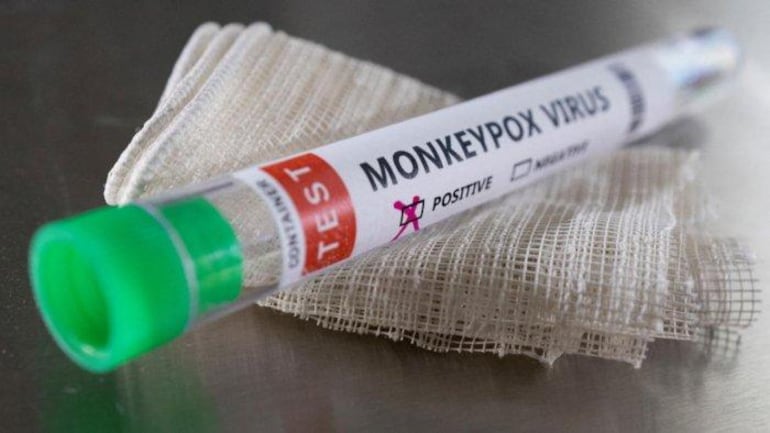 Los Angeles reports area’s first death due to monkeypox; 2nd known death in the US