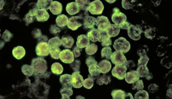 US: Florida resident dies from brain-eating Amoeba