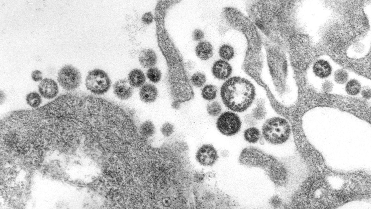 US: Resident in Iowa, who visited West Africa, dies of rare Lassa fever, officials say