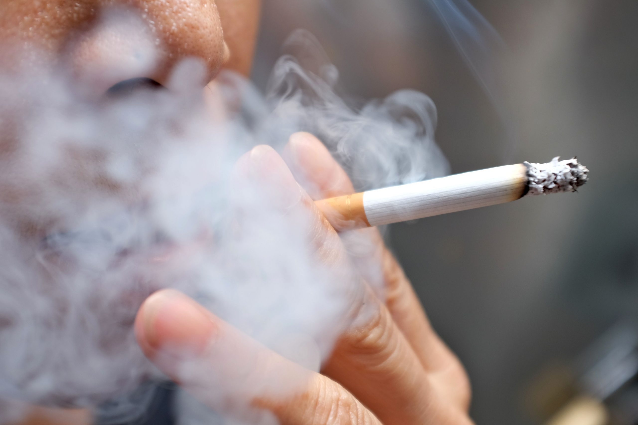 Smoking causes 6,000 deaths per year in Cote d’Ivoire